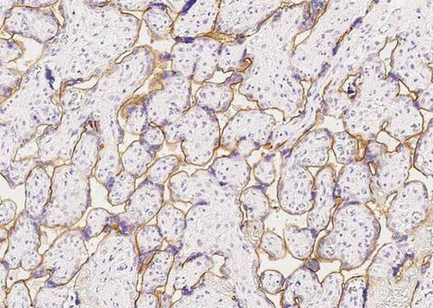 Anti-Human INSR Antibody [A881] - ABMIUM