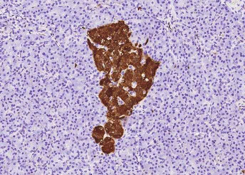 Anti-Human ENO2 Antibody [A1080] - ABMIUM