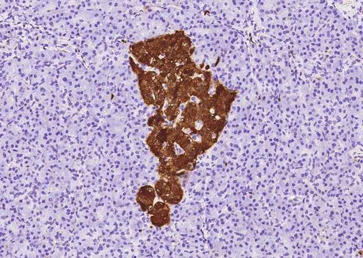 Anti-Human ENO2 Antibody [A1080] - ABMIUM