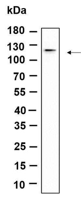 Anti-Human/Mouse/Rat DDR1 Antibody [B1163]
