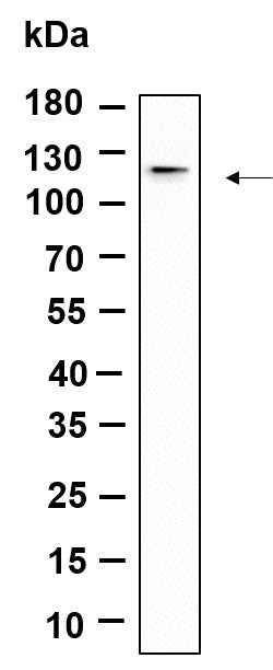 Anti-Human/Mouse/Rat DDR1 Antibody [B1163] - ABMIUM
