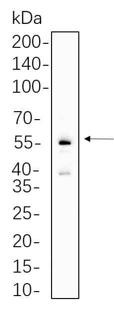 Anti-Human/Mouse/Rat Parkin Antibody [B633] - ABMIUM