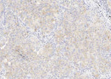 Anti-Human CD47 Antibody [A976] - ABMIUM