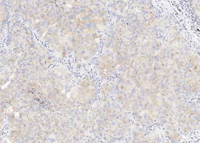 Anti-Human CD47 Antibody [A976] - ABMIUM
