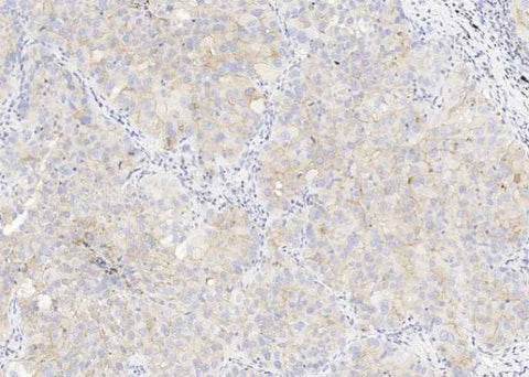 Anti-Human CD47 Antibody [A976] - ABMIUM