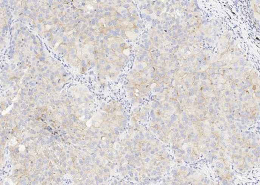 Anti-Human CD47 Antibody [A976] - ABMIUM