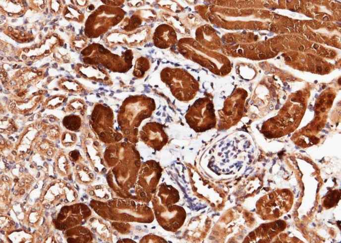 Anti-Mouse CNDP2 Antibody [B427]