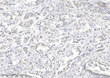 Anti-Human STAT5a Antibody [3G5] - ABMIUM