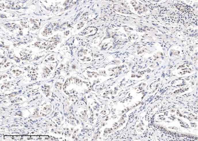 Anti-Human STAT5a Antibody [3G5] - ABMIUM