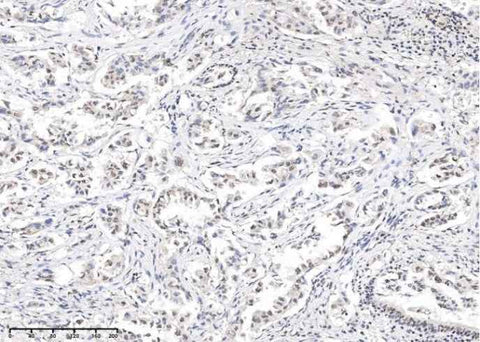 Anti-Human STAT5a Antibody [3G5] - ABMIUM