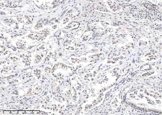 Anti-Human STAT5a Antibody [3G5] - ABMIUM