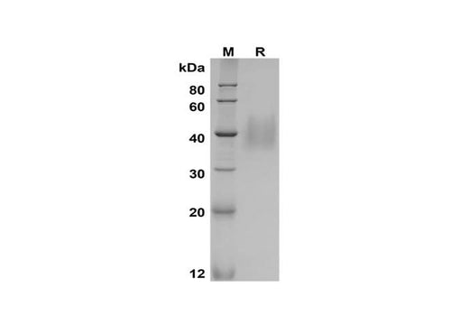 SDS-PAGE analysis of Mouse KIM-1 proteins, 2 μg/lane of Recombinant Mouse KIM-1 proteins, was resolved with SDS-PAGE under reducing conditions, showing bands at 38-45 kDa.