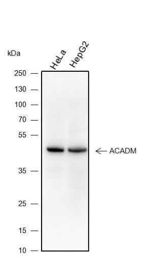 Anti-Human ACADM Antibody [A120] - ABMIUM