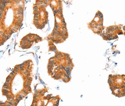 Anti-Human/Mouse/Rat ACOX1 Antibody