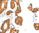 Anti-Human/Mouse/Rat ACOX1 Antibody - ABMIUM