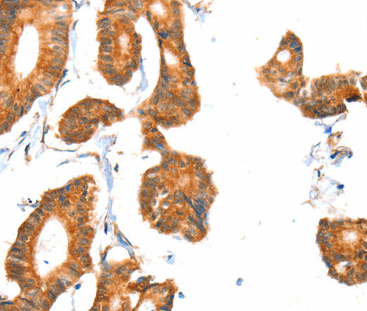 Anti-Human/Mouse/Rat ACOX1 Antibody - ABMIUM