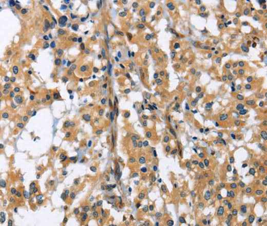 Anti-Human/Mouse GAB1 Antibody