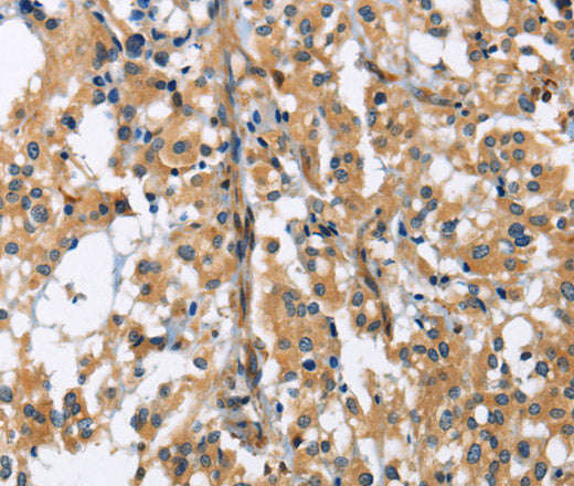 Anti-Human/Mouse GAB1 Antibody - ABMIUM