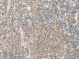 Immunohistochemistry of paraffin-embedded Human tonsil tissue using HSPA4L Polyclonal Antibody at dilution of 1:30(×200)