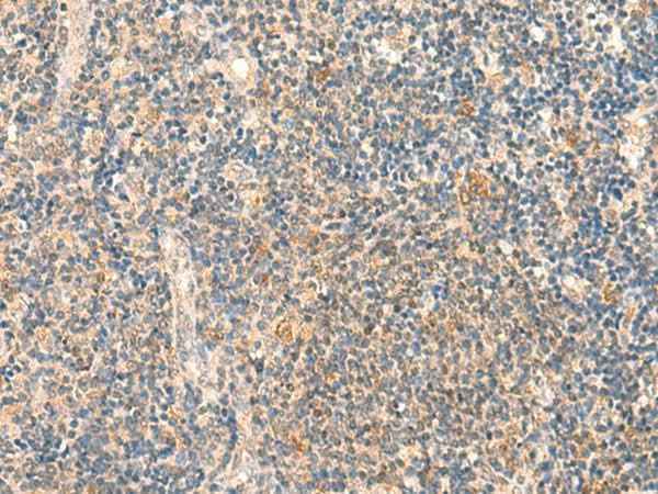 Anti-Human/Mouse HSPA4L Antibody