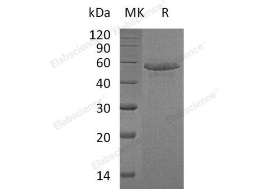 Recombinant Human Calmegin/CLGN Protein (His Tag) - ABMIUM