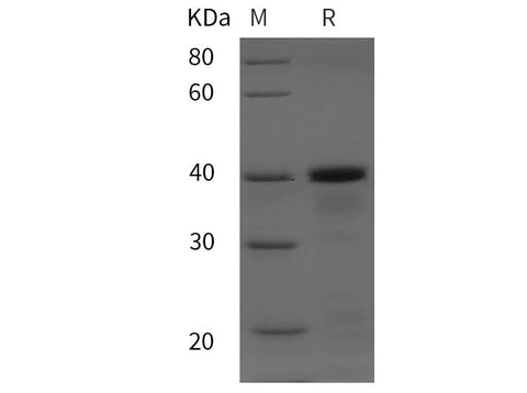 SDS-PAGE analysis of Gekko japonicus PDGFC proteins, 2 μg/lane of Recombinant Gekko japonicus PDGFC proteins was resolved with SDS-PAGE under reducing conditions, showing bands at 40 kDa.