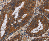Anti-Human KLK11 Antibody - ABMIUM
