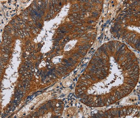 Anti-Human KLK11 Antibody - ABMIUM