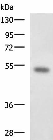 Anti-Human FOXQ1 Antibody - ABMIUM