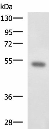 Anti-Human FOXQ1 Antibody - ABMIUM