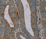 Anti-Human/Mouse/Rat PYY Antibody - ABMIUM