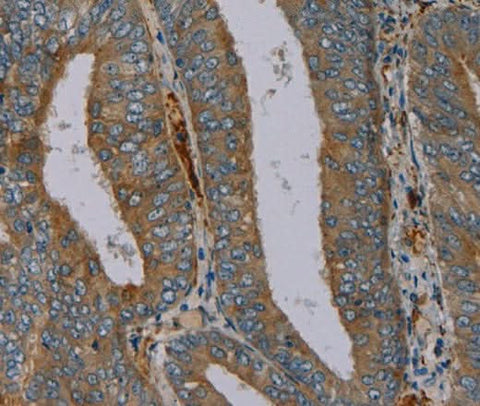 Anti-Human/Mouse/Rat PYY Antibody - ABMIUM