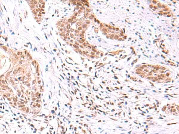 Anti-Human/Rat TRMT12 Antibody
