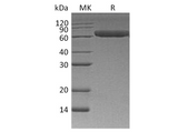 Recombinant Human ROR1 Protein (His Tag) - ABMIUM
