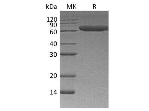 Recombinant Human ROR1 Protein (His Tag) - ABMIUM