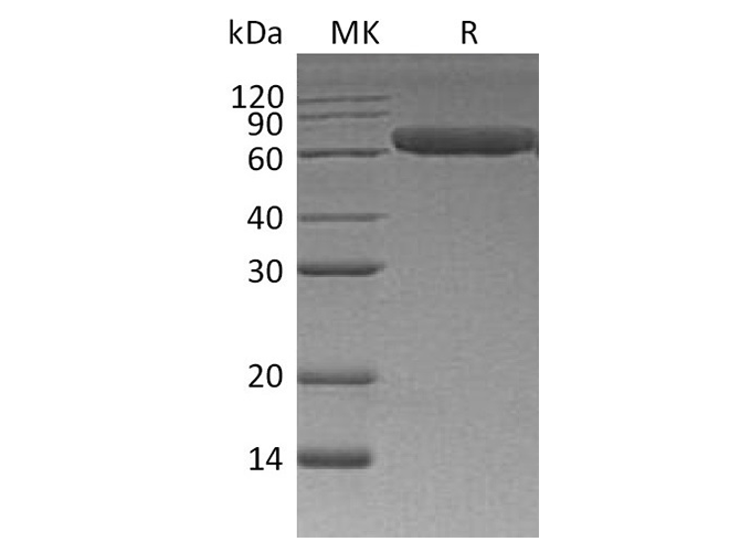 Recombinant Human ROR1 Protein (His Tag) - ABMIUM