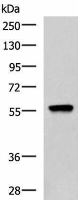 Western blot analysis of A549 cell lysate using TERF1 Polyclonal Antibody at dilution of 1:1000