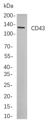 Anti-Human CD43 Antibody [B791]
