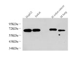 Western Blot analysis of various samples using c-Fos Monoclonal Antibody at dilution of 1:1000.