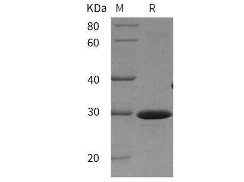 SDS-PAGE analysis of Mouse FGFR3 proteins, 2 μg/lane of Recombinant Mouse FGFR3 proteins was resolved with SDS-PAGE under reducing conditions, showing bands at 30 kDa.