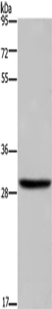 Anti-Human/Mouse DHRS3 Antibody - ABMIUM