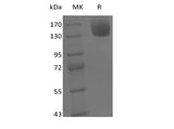 Recombinant Mouse Leptin Receptor/LEPR/CD295 (C-Fc) - ABMIUM