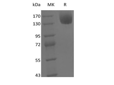 Recombinant Mouse Leptin Receptor/LEPR/CD295 (C-Fc) - ABMIUM