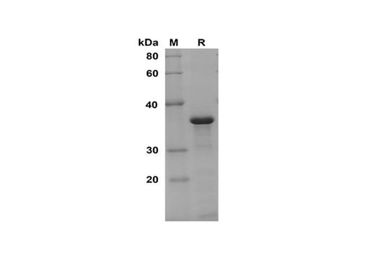 SDS-PAGE analysis of Human CEACAM8/CD66b/CD67 proteins, 2 μg/lane of Recombinant Human CEACAM8/CD66b/CD67 proteins was resolved with SDS-PAGE under reducing conditions, showing bands at 36 kDa.