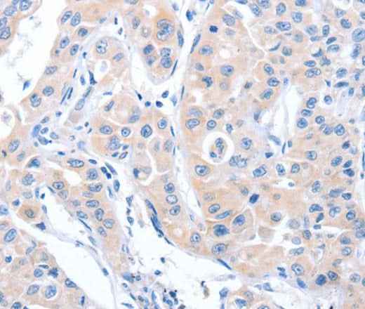 Anti-Human/Mouse/Rat ARHGEF6 Antibody