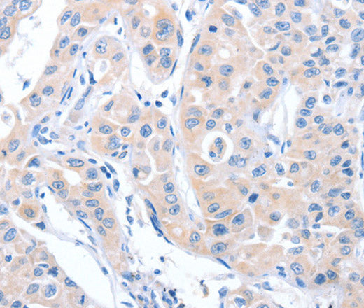 Anti-Human/Mouse/Rat ARHGEF6 Antibody - ABMIUM