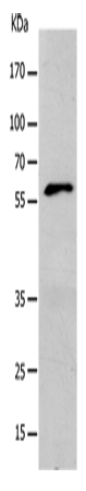 Anti-Human/Mouse KCNC1 Antibody - ABMIUM