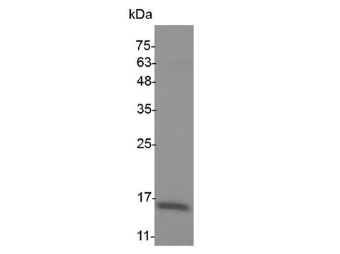 Recombinant Mouse IL-24 protein(His Tag) - ABMIUM