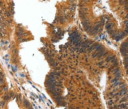 Anti-Human/Mouse BIRC6 Antibody