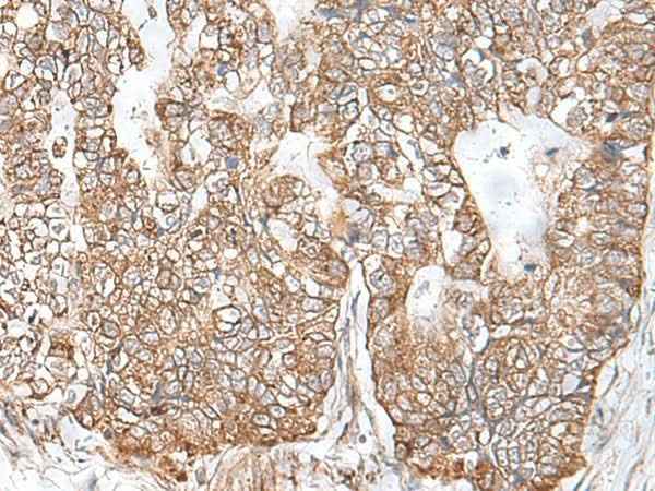 Anti-Human RNF111 Antibody